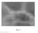 Fig. 02 - Stable liquid detergent composition containing a self-structuring surfactant system