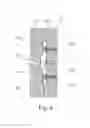 Fig. 07 - Nozzle plate for fuel injection unit