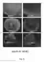 Fig. 06 - HLA G-modified cells and methods