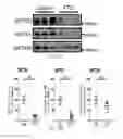 Fig. 44 - Biomarkers of congnitive dysfunction