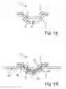 Fig. 02 - Medical device with pre-defined space and related methods