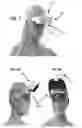 Fig. 07 - Wearable vision redirecting devices
