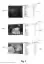 Fig. 07 - Utilizing deep learning for rating aesthetics of digital images