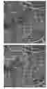 Fig. 01 - Systems and methods for quantitative assessment of microvasculature using optical coherence tomography angiography