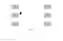 Fig. 07 - Film Patterning Method
