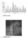 Fig. 28 - Coated pre-lithiated anode material particles and cross-linked polymer coatings