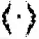 Fig. 02 - Hearing device comprising a beamformer filtering unit