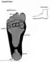 Fig. 03 - Hosiery with Foot Cushions