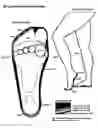 Fig. 05 - Hosiery with Foot Cushions