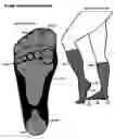 Fig. 06 - Hosiery with Foot Cushions
