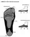 Fig. 07 - Hosiery with Foot Cushions