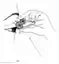 Fig. 04 - Eyelash curler