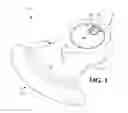 Fig. 02 - Leveling device