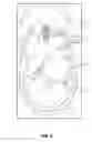 Fig. 07 - MOVING INLET NOZZLES IN BEVERAGE SYSTEMS