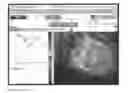 Fig. 01 - METHOD OF QUANTIFYING ISCHEMIA/PERFUSION AND BLOOD FLOW ABNORMALITIES