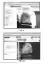 Fig. 06 - METHOD OF QUANTIFYING ISCHEMIA/PERFUSION AND BLOOD FLOW ABNORMALITIES