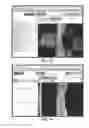 Fig. 08 - METHOD OF QUANTIFYING ISCHEMIA/PERFUSION AND BLOOD FLOW ABNORMALITIES