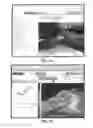 Fig. 09 - METHOD OF QUANTIFYING ISCHEMIA/PERFUSION AND BLOOD FLOW ABNORMALITIES
