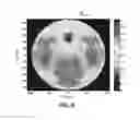 Fig. 07 - UWB microwave imaging system with a novel calibration approach for breast cancer detection