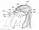 Fig. 01 - Headset for neurostimulation and sensing of body parameters