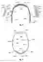 Fig. 06 - Headset for neurostimulation and sensing of body parameters