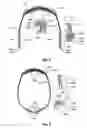 Fig. 07 - Headset for neurostimulation and sensing of body parameters