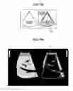Fig. 08 - ULTRASONIC DIAGNOSTIC DEVICE AND METHOD OF GENERATING DISCRIMINATION INFORMATION