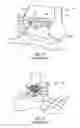 Fig. 02 - Surgical instrumentation and methods of use for implanting a prosthesis