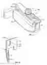 Fig. 04 - Surgical instrumentation and methods of use for implanting a prosthesis