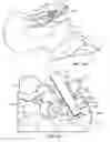 Fig. 22 - Surgical instrumentation and methods of use for implanting a prosthesis