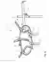 Fig. 08 - Surgical retractor with light