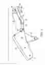 Fig. 02 - Devices and methods for surgical suturing