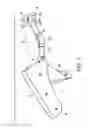 Fig. 02 - Devices and methods for surgical suturing