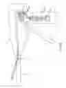 Fig. 63 - Surgical instrument with multiple program responses during a firing motion