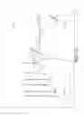 Fig. 87 - Surgical instrument with multiple program responses during a firing motion