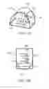 Fig. 80 - Systems and methods for increased operating room efficiency