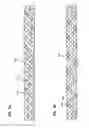 Fig. 45 - Surgical braid having alternate cores