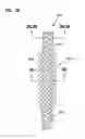 Fig. 46 - Surgical braid having alternate cores