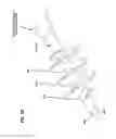 Fig. 72 - Surgical braid having alternate cores