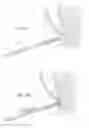 Fig. 09 - SURGICAL FIXATION DEVICES, SYSTEMS, AND METHODS