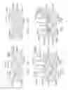 Fig. 07 - Surgical instrument comprising a replaceable cartridge jaw
