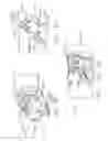 Fig. 16 - Surgical instrument comprising a replaceable cartridge jaw