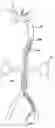 Fig. 01 - Partial aortic occlusion devices and methods for cerebral perfusion augmentation