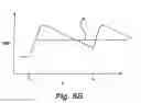 Fig. 07 - Partial aortic occlusion devices and methods for cerebral perfusion augmentation