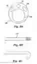 Fig. 09 - Partial aortic occlusion devices and methods for cerebral perfusion augmentation