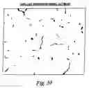 Fig. 37 - Partial aortic occlusion devices and methods for cerebral perfusion augmentation