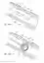 Fig. 34 - Implantable luminal devices