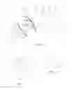 Fig. 05 - Method and device for joint replacement