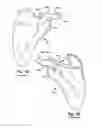 Fig. 02 - System of preoperative planning and provision of patient-specific surgical aids