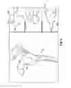 Fig. 08 - System of preoperative planning and provision of patient-specific surgical aids